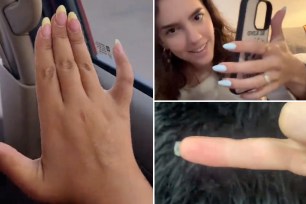 TikToker shoving hand with severely bent pinky, her long nails seen in screenshot; top right, TikToker showing how phone case fits in the crook of her bent pinky; bottom right showing pinky finger with dent in it