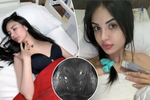 An influencer who had several plastic surgeries is warning about damaging effects a butt filler had left on herself.