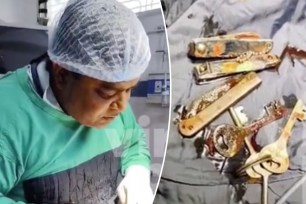 Doctors in India were taken aback after removing keys, nail clippers, and even a knife from the stomach of a 20-year-old man.